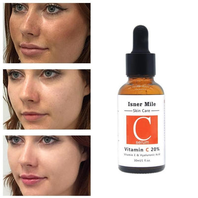 Original Liquid Niacinamide Hyaluronic Acid Serum itouch exclusive botique