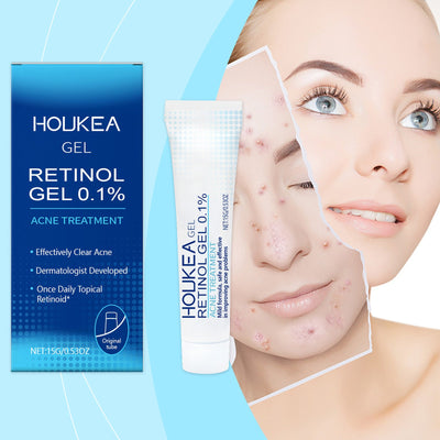 Gentle Cleansing Facial Acne Gel iTouch Exclusive Boutique